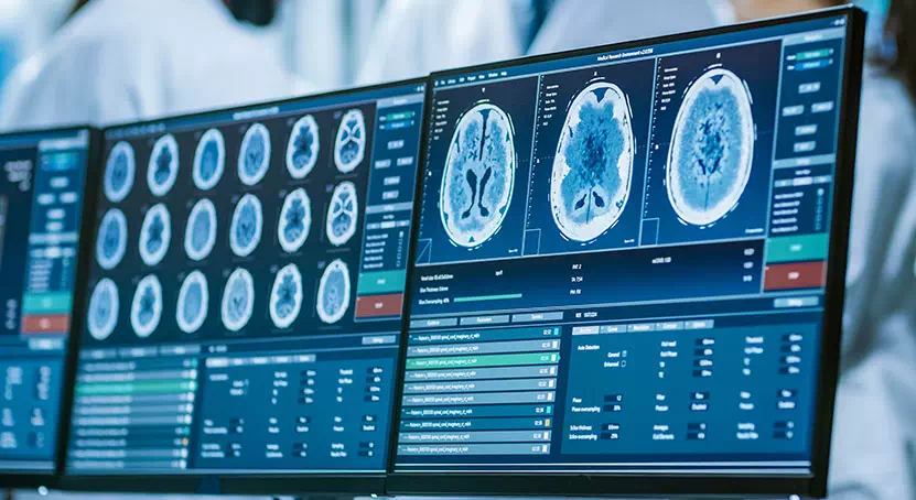 MRI Fistulogram