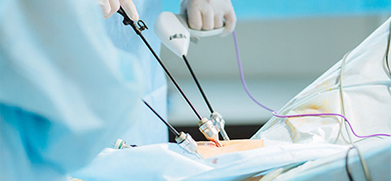 Advanced laparoscopy in Gynaecology