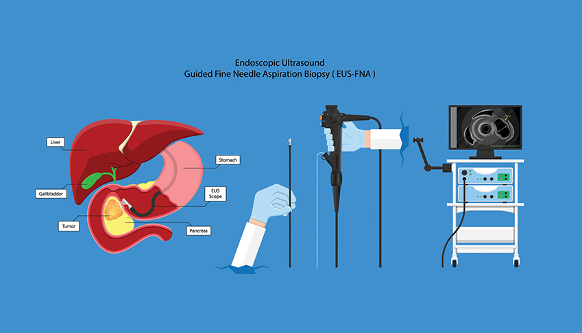 CT & Ultrasound Guided Biopsies