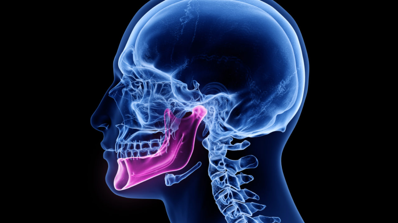 TMJ Disorders